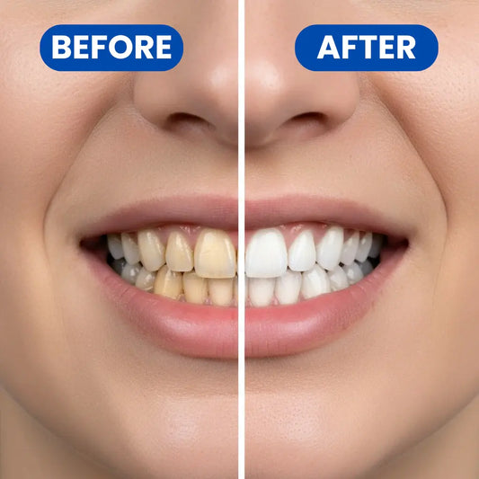 Teeth Whitening Strips