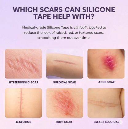 Silicone Collagen Sheets
